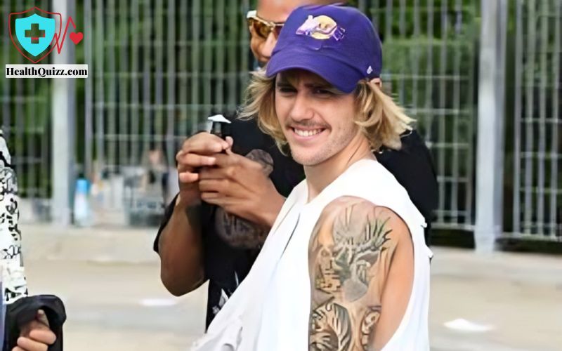 What Disease Does Justin Bieber Have
