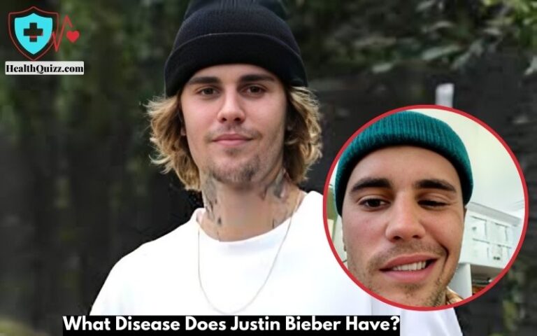 What Disease Does Justin Bieber Have